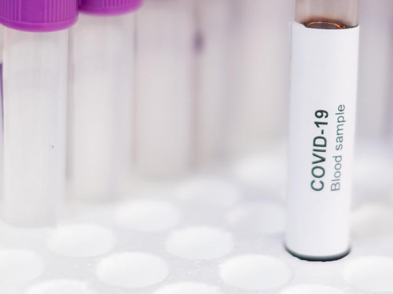 Liquidity and Capital Management Specialty Issue Hero