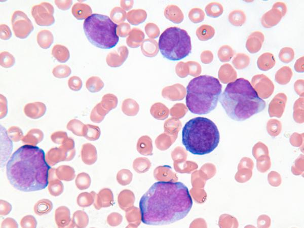 Ariad Raises $200 Million in Synthetic Royalty Financing with PDL BioPharma